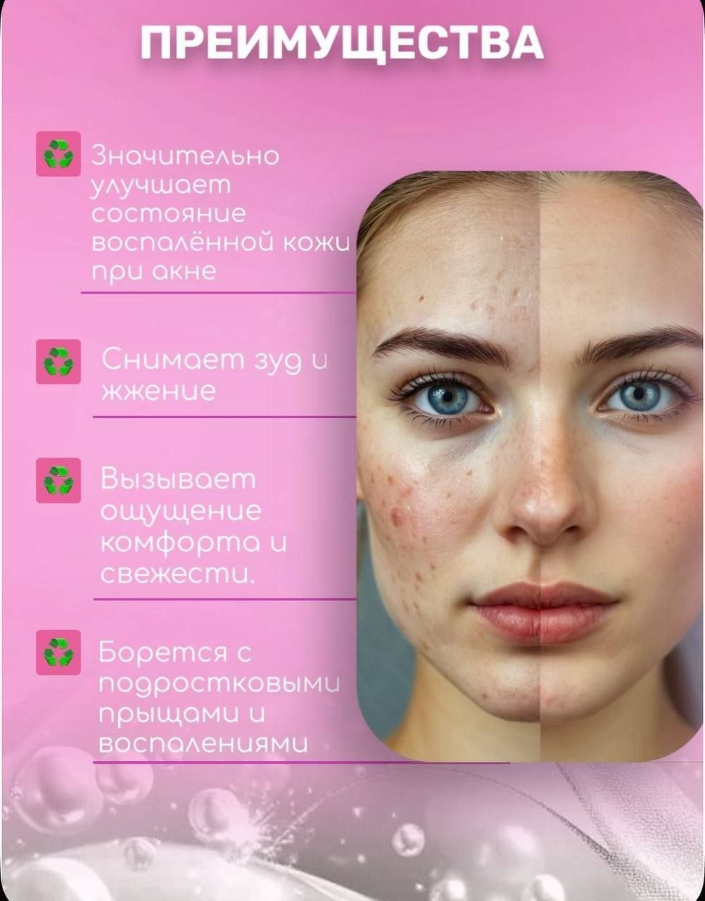 SILVER ANTI-ACNE 100 мл, фото 8